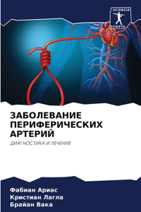 ЗАБОЛЕВАНИЕ ПЕРИФЕРИЧЕСКИХ АРТЕРИЙ
