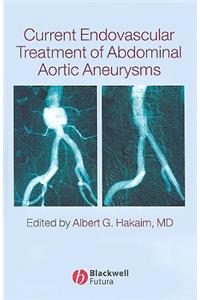 Current Endovascular Treatment of Abdominal Aortic Aneurysms