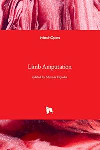 Limb Amputation