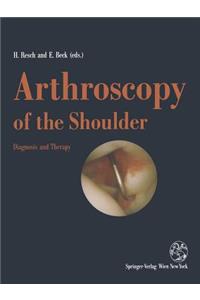 Arthroscopy of the Shoulder