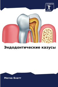 Эндодонтические казусы