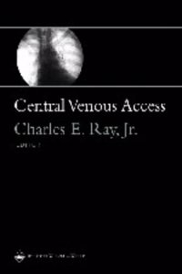 Central Venous Access