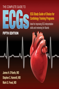 Complete Guide to Ecgs: A Comprehensive Study Guide to Improve ECG Interpretation Skills