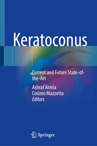 Keratoconus