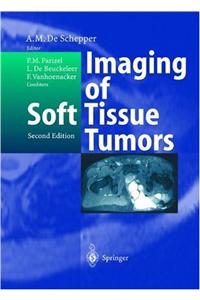 Imaging of Soft Tissue Tumors