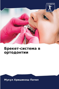 Брекет-система в ортодонтии