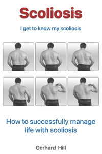 Scoliosis