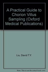 Practical Guide to Chorion Villus Sampling