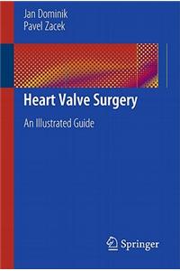 Heart Valve Surgery