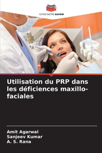 Utilisation du PRP dans les déficiences maxillo-faciales