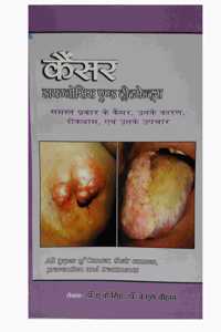CANCER DIAGNOSIS & TREATMENT