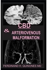 CBD & Arteriovenous Malformation