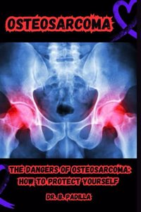 Osteosarcoma