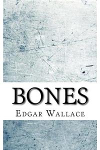 Bones