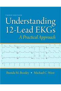 Understanding 12-Lead EKGs: A Practical Approach