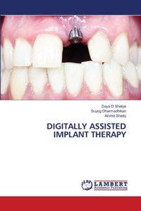 Digitally Assisted Implant Therapy