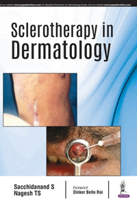 Sclerotherapy In Dermatology