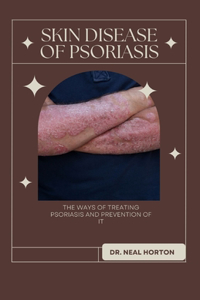 Skin Disease of Psoriasis