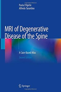 MRI of Degenerative Disease of the Spine