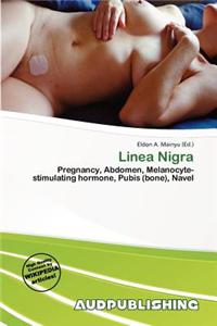 Linea Nigra