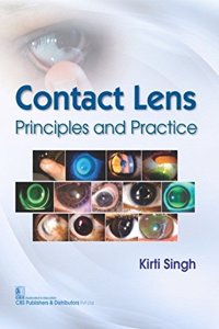 Contact Lens