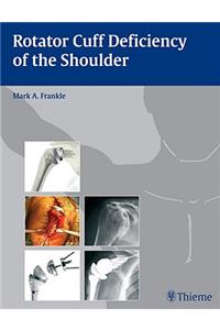 Rotator Cuff Deficiency of the Shoulder