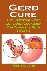 Gerd Cure