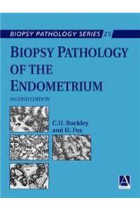 Biopsy Pathology of the Endometrium, 2Ed