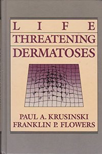Life-Threatening Dermatoses