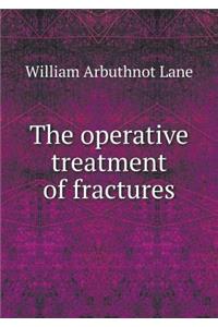 The operative treatment of fractures