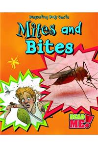 Mites and Bites