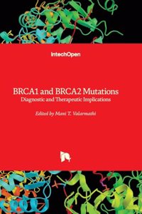 BRCA1 and BRCA2 Mutations - Diagnostic and Therapeutic Implications
