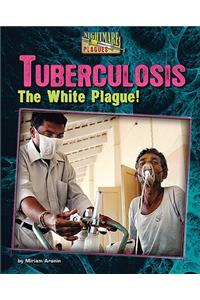 Tuberculosis