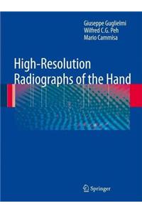 High-Resolution Radiographs of the Hand