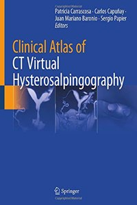 Clinical Atlas of CT Virtual Hysterosalpingography