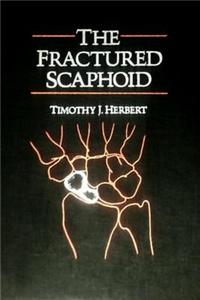 Fractured Scaphoid