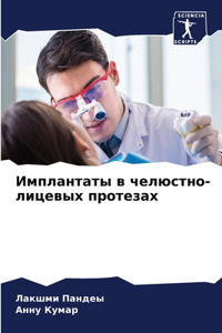 Имплантаты в челюстно-лицевых протезах