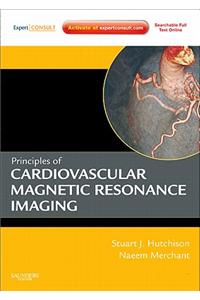 Principles of Cardiovascular Magnetic Resonance Imaging