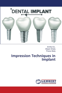 Impression Techniques in Implant