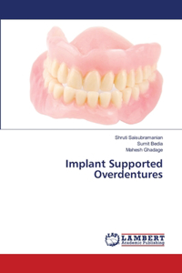 Implant Supported Overdentures