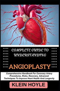 Complete Guide to Understanding Angioplasty