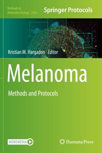 Melanoma