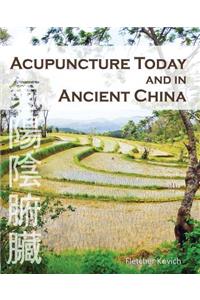 Acupuncture Today and in Ancient China