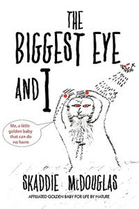 Biggest Eye and I