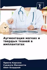 Аугментация мягких и твердых тканей в им
