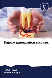 Зарождающийся кариес