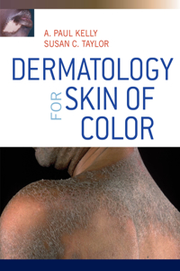 Dermatology for Skin of Color