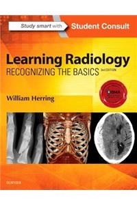 Learning Radiology: Recognizing the Basics