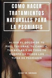 Como Hacer Tratamientos Naturales Para La Psoriasis