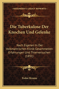 Tuberkulose Der Knochen Und Gelenke